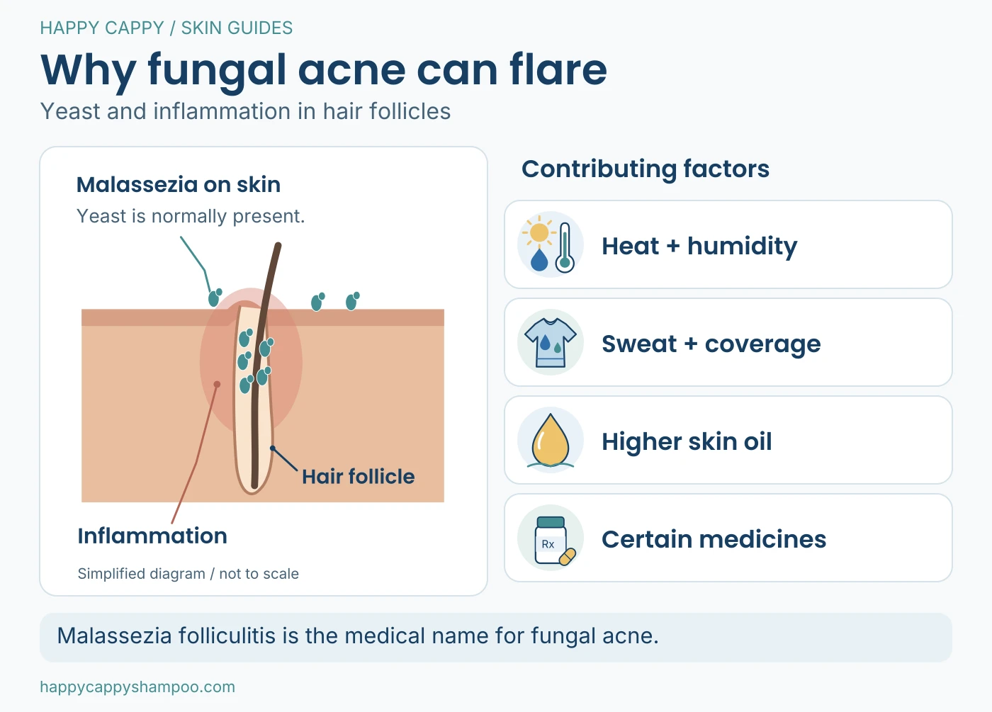 Labeled schematic of Malassezia yeast and inflammation around a hair follicle, beside contributing factors: heat, sweat, occlusion, skin oil and certain medicines.