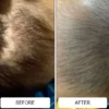 Cradle cap flakes in a baby's dark hair before and after two weeks of Happy Cappy medicated shampoo
