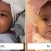 Fine cradle cap flakes on a baby's scalp before and a clear scalp after Happy Cappy medicated shampoo
