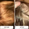 Cradle cap flakes near a baby's hairline before and a clear scalp after using Happy Cappy medicated shampoo