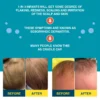 Two cradle cap before and after scalp comparisons, with a note that these symptoms are seborrheic dermatitis