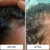 Cradle cap flakes in a baby's textured hair before and after using Happy Cappy medicated shampoo