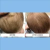 A baby's cradle cap with greasy scalp flaking before and after two weeks of Happy Cappy medicated shampoo