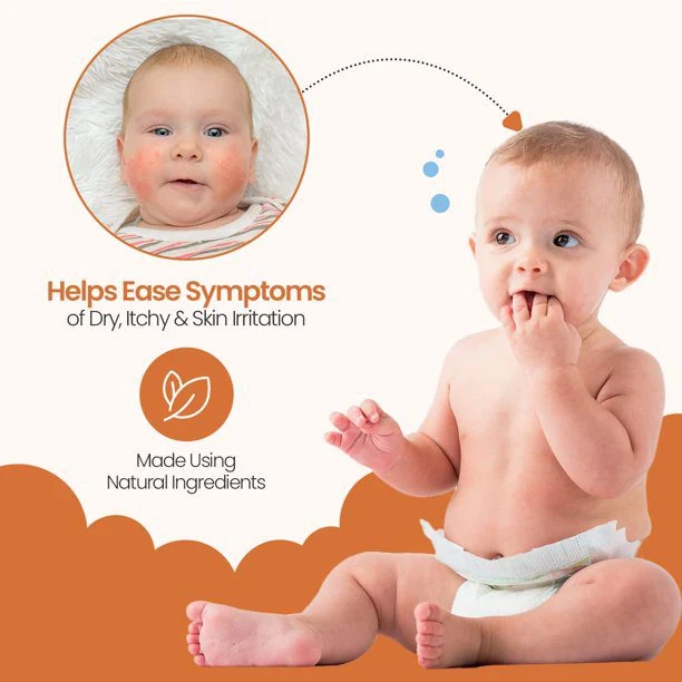 Infographic with a baby who has red cheeks, daily wash made to ease dry, itchy, irritated skin