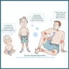 Cartoon diagram of where eczema, atopic dermatitis, tends to appear on a baby, a child and an adult