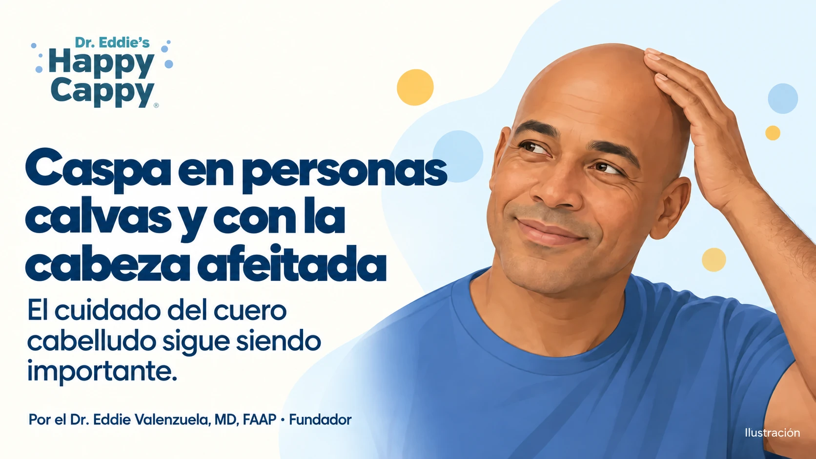 Ilustración de un hombre calvo tocándose suavemente el cuero cabelludo, con el título «Caspa en personas calvas y con la cabeza afeitada».