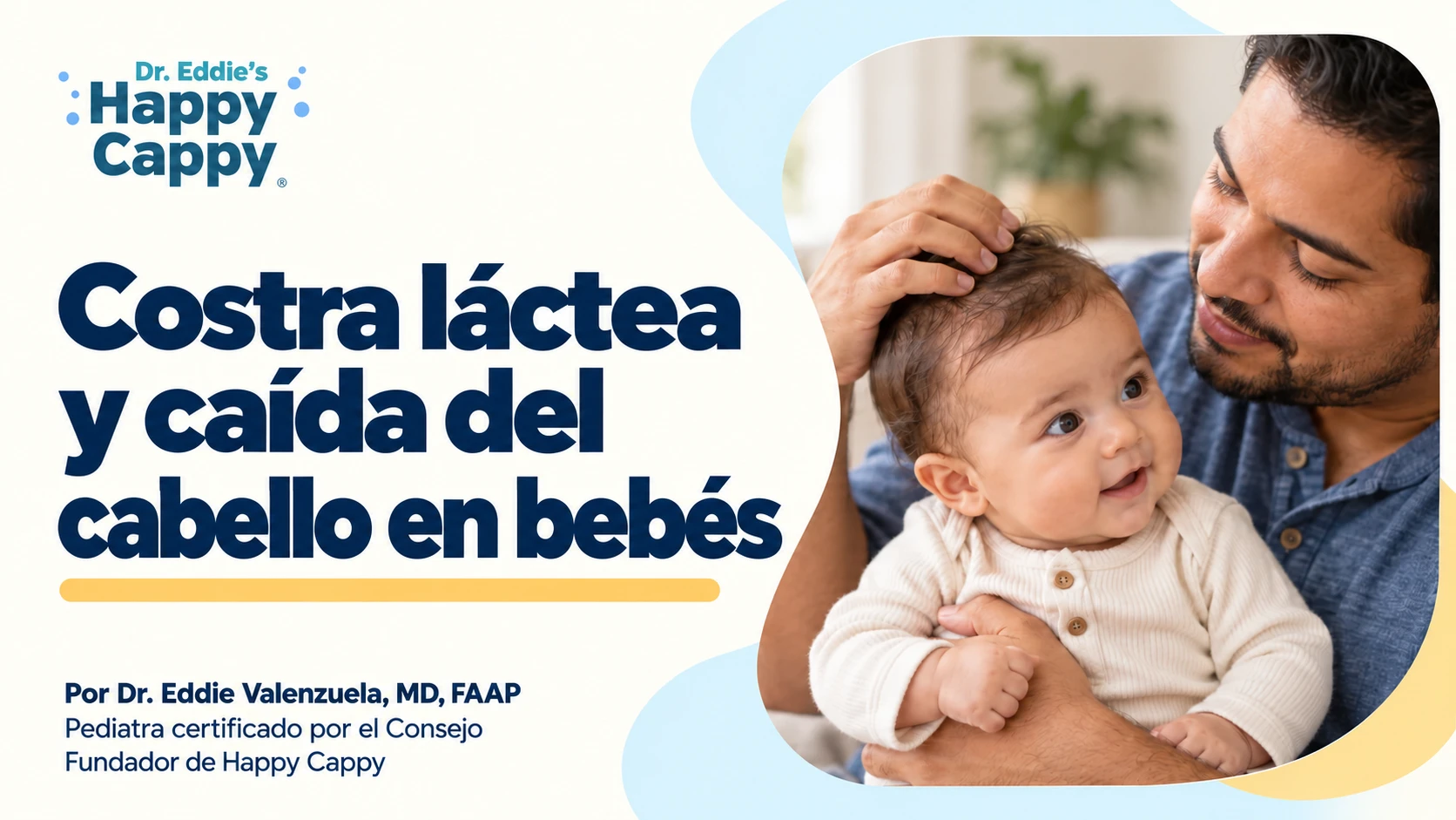 Un padre sostiene a su bebé y toca suavemente su cabello junto al título sobre la costra láctea y la caída del cabello.