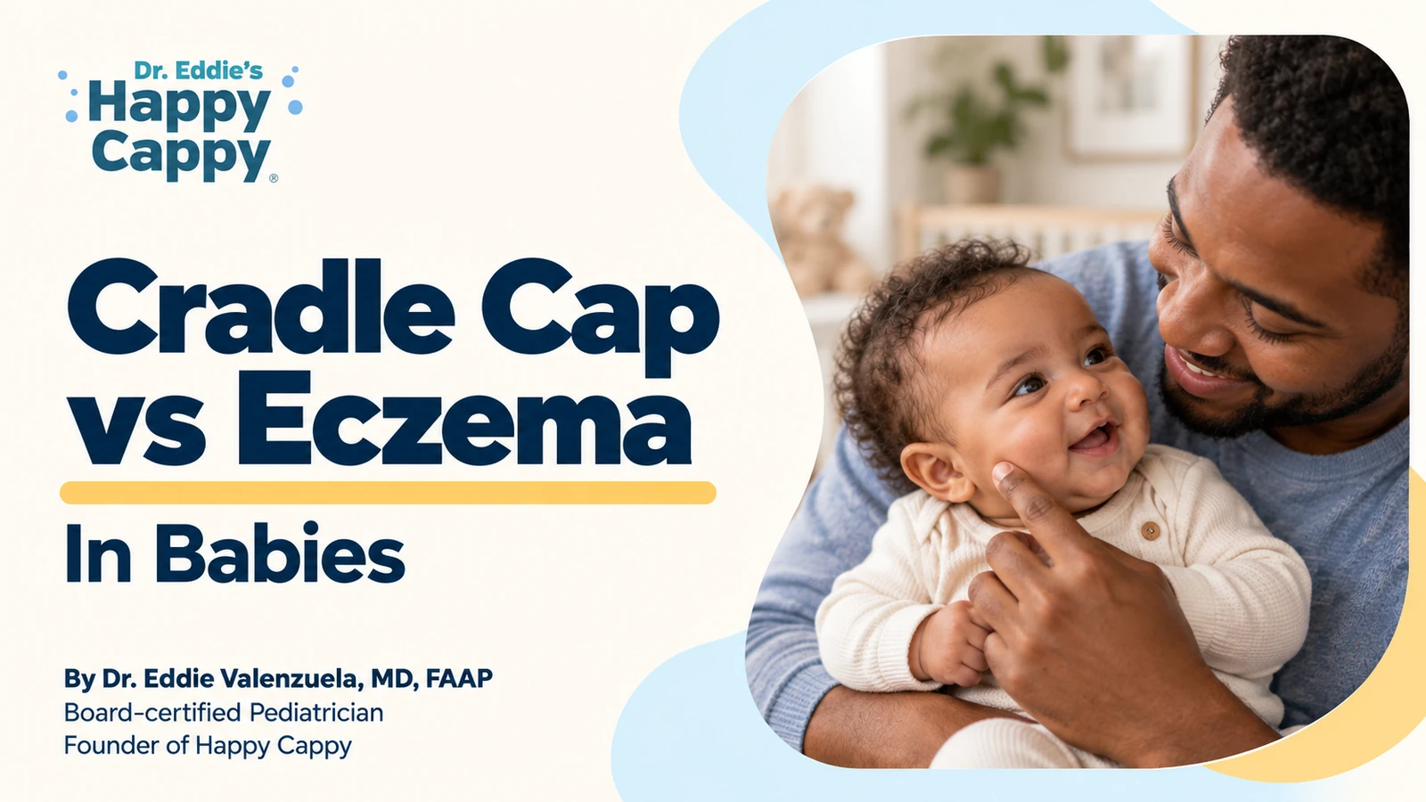 Cradle Cap vs Eczema in Babies