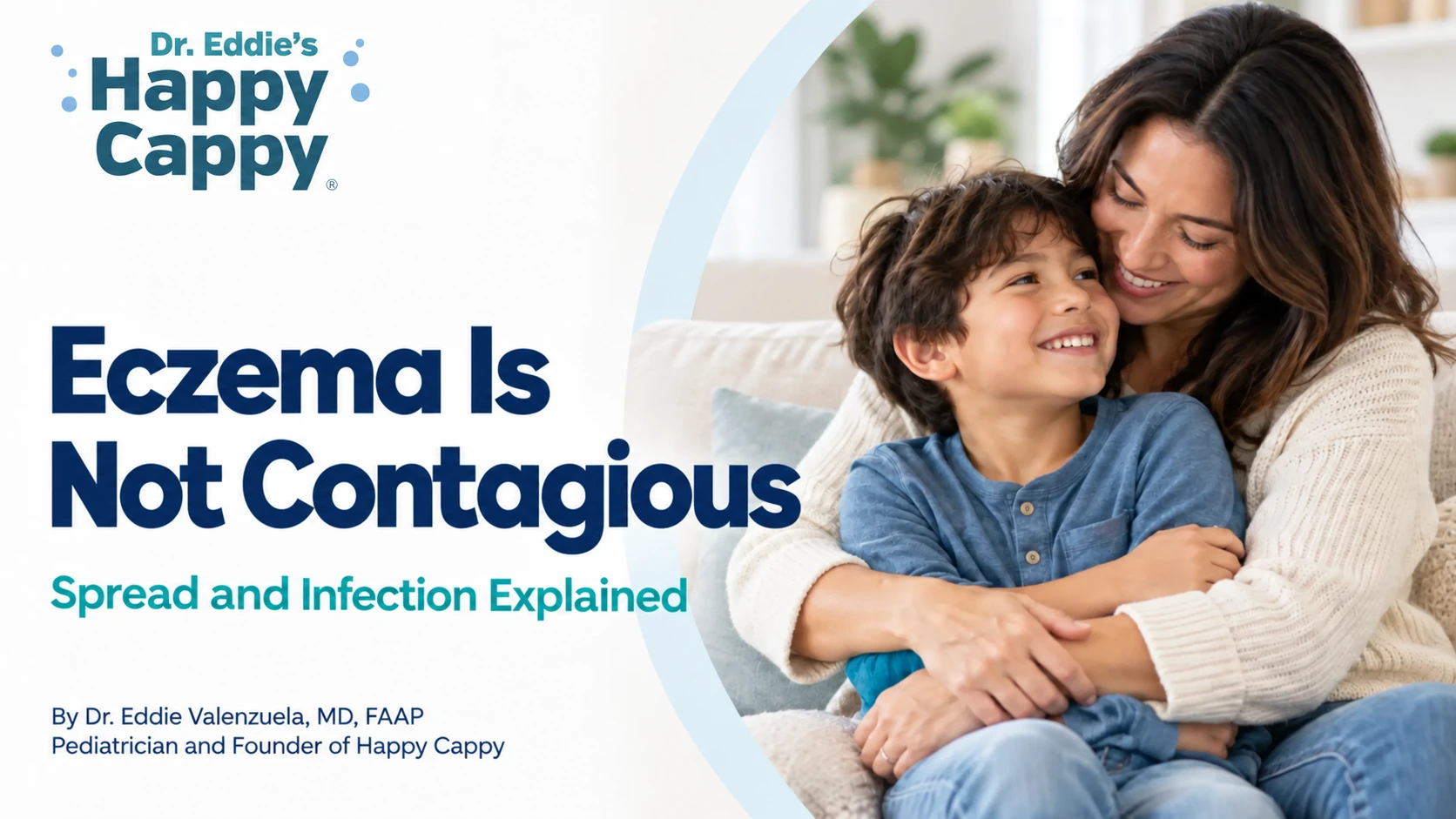 Eczema Is Not Contagious