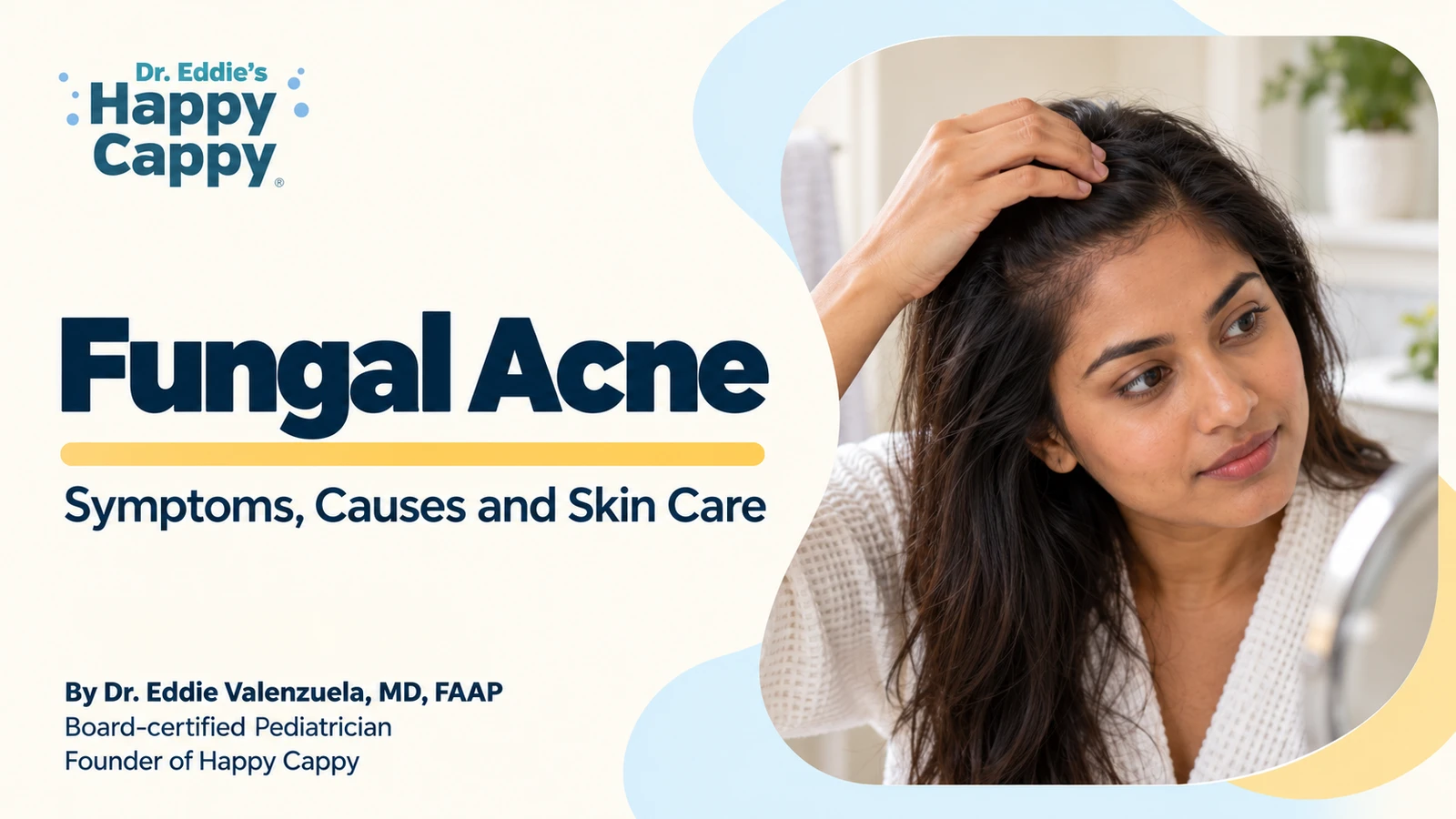 Fungal Acne: Symptoms, Causes and Skin Care