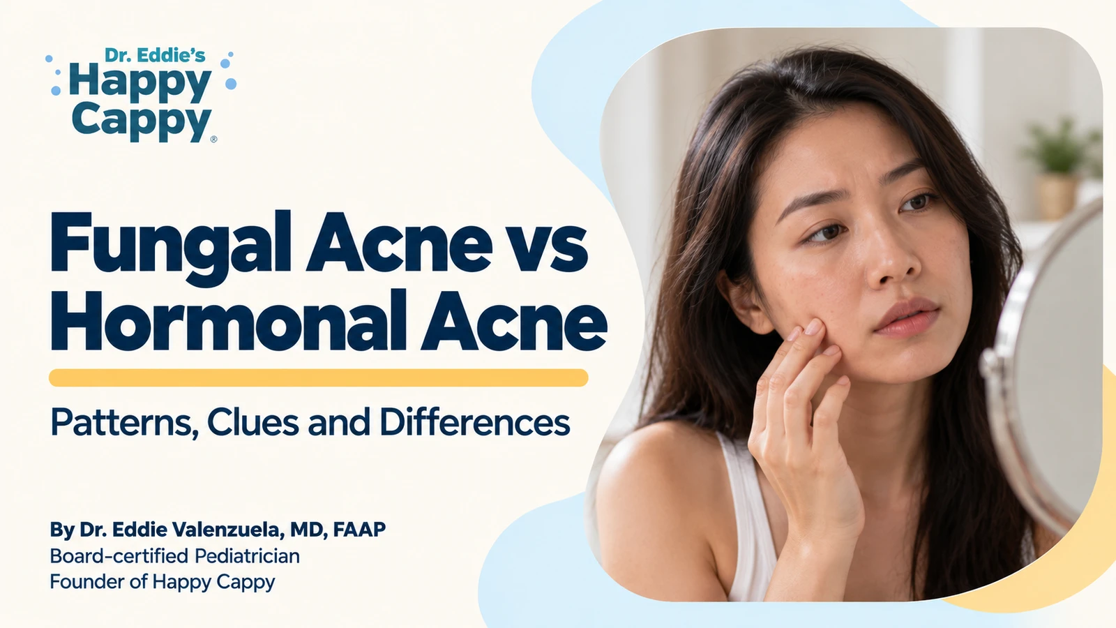 Fungal Acne vs Hormonal Acne: Patterns, Clues and Differences