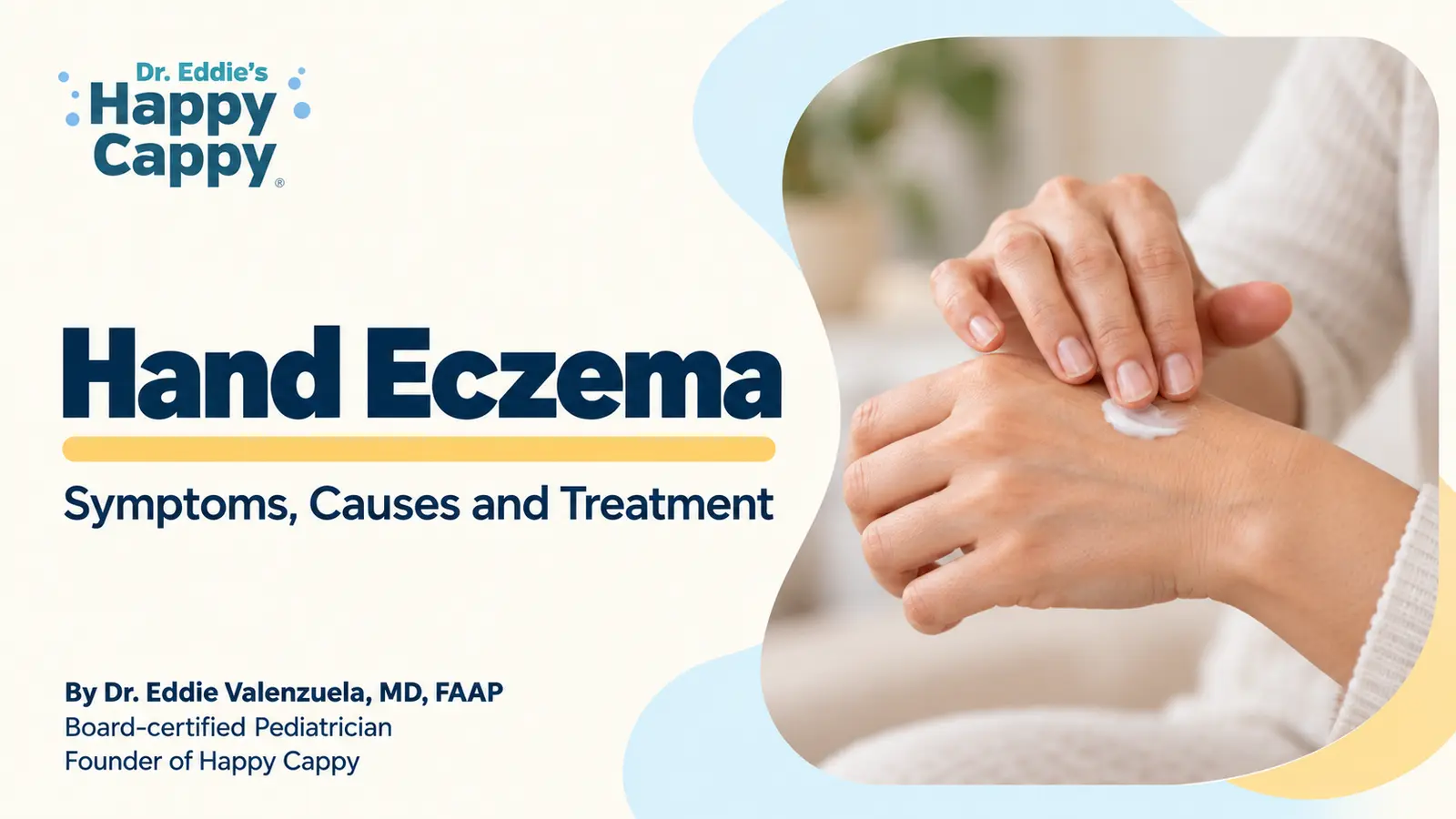 Hand Eczema: Symptoms, Causes and Treatment. Editorial illustration.