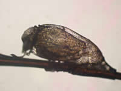 Magnified head louse egg attached to a hair shaft, with a nymph beginning to hatch.