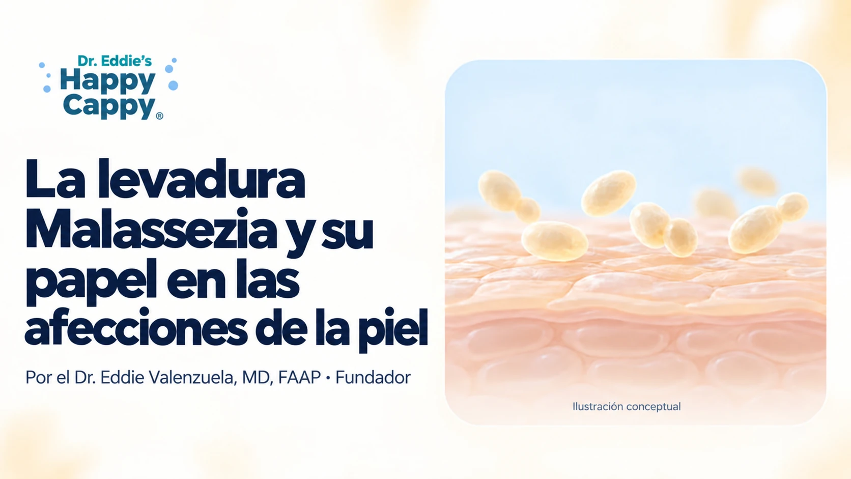 La levadura Malassezia y su papel en las afecciones de la piel, con una ilustración conceptual de levaduras cerca de la superficie cutánea.