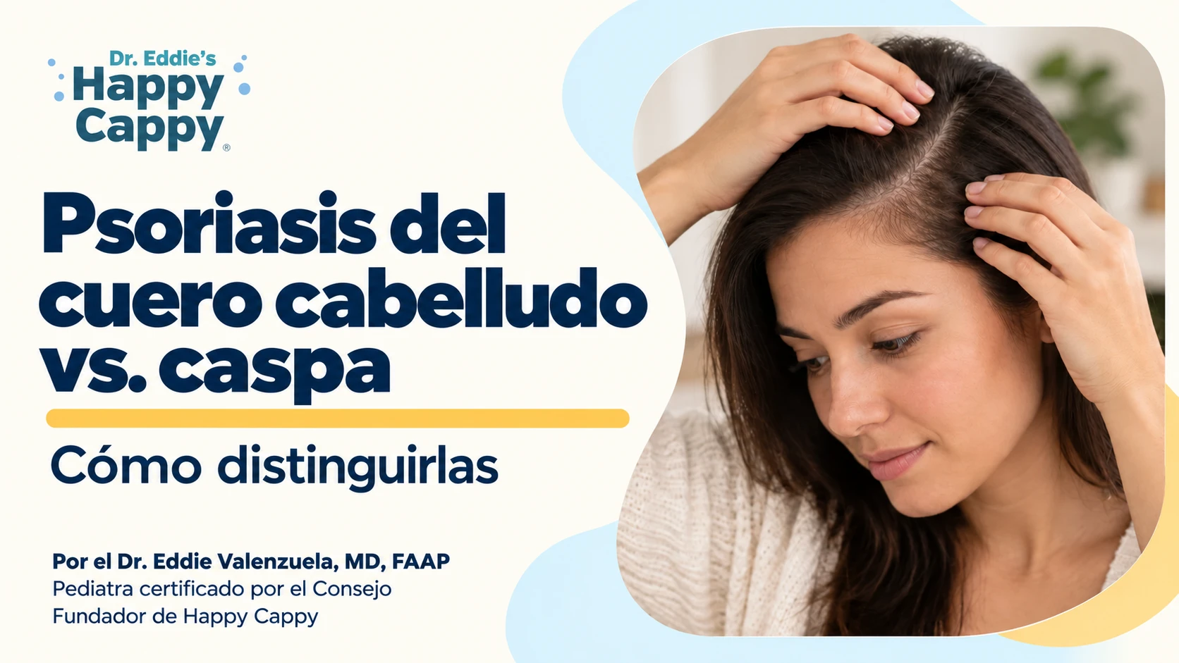 Psoriasis del cuero cabelludo vs. caspa: cómo distinguirlas