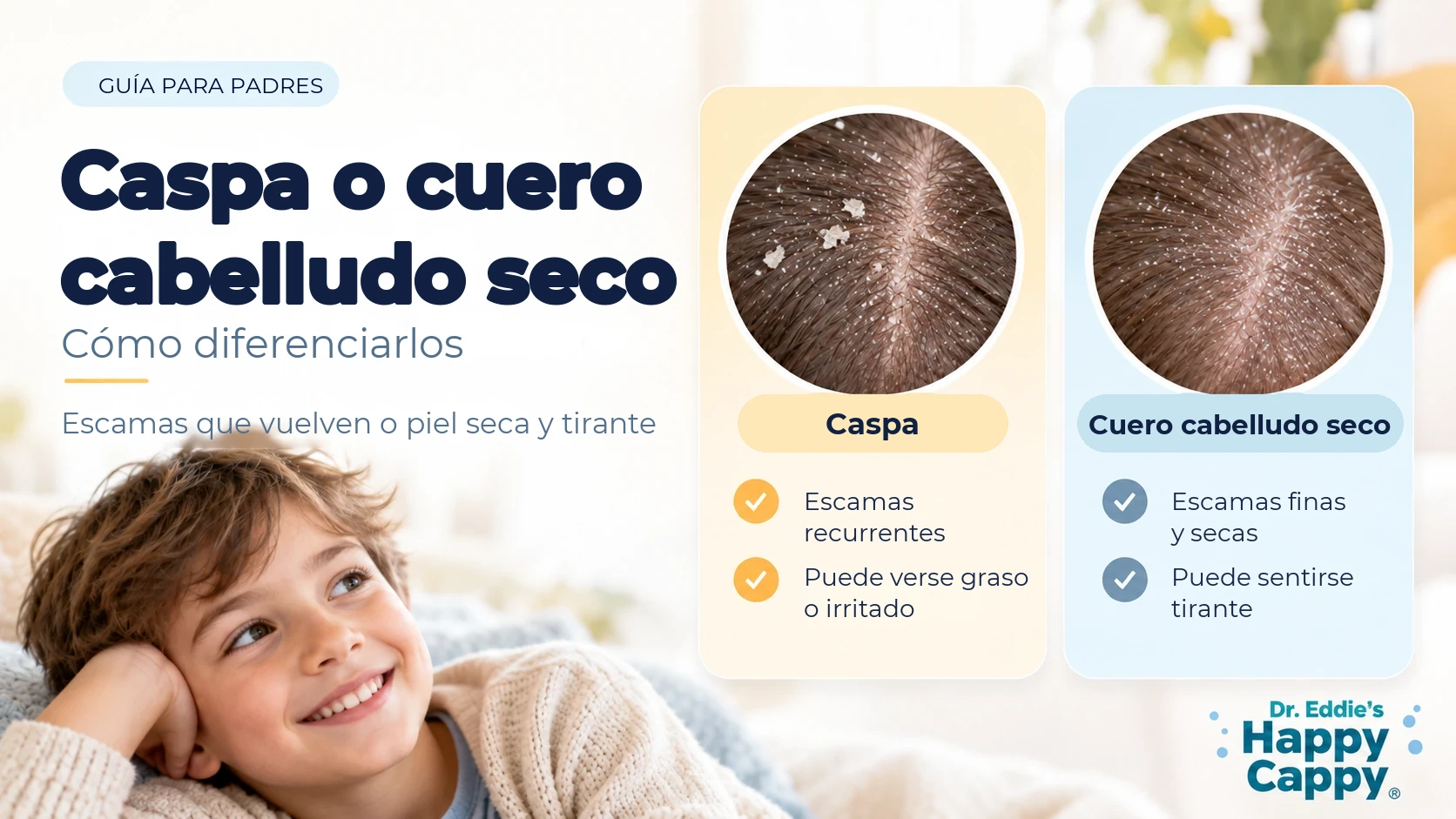 Ilustración en español que compara la caspa, con escamas recurrentes y un cuero cabelludo graso o irritado, y el cuero cabelludo seco, con escamas finas y secas y sensación de tirantez.
