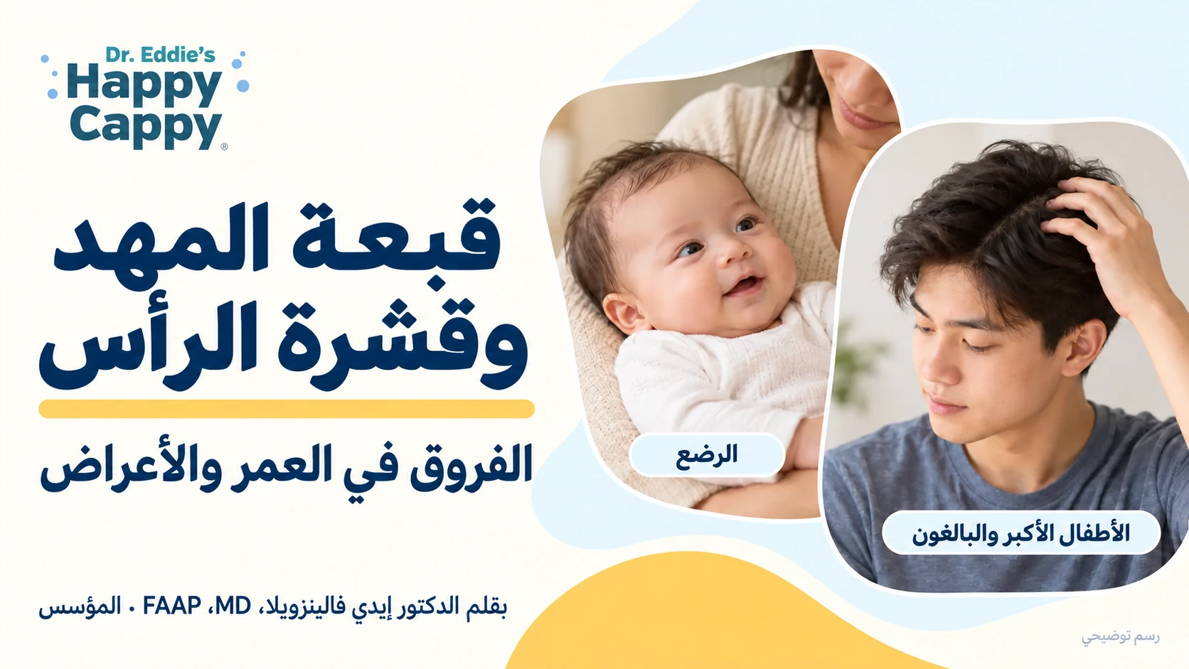 مقارنة قبعة المهد وقشرة الرأس من حيث العمر والمظهر والأعراض.