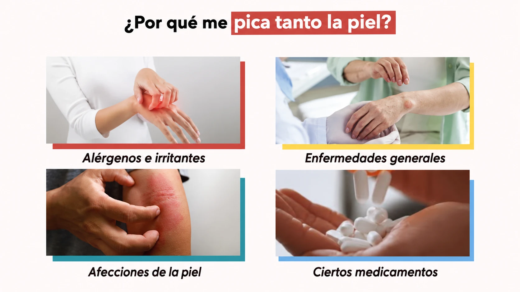 Cuatro categorías de causas de picazón: alérgenos e irritantes, enfermedades generales, afecciones cutáneas y ciertos medicamentos.