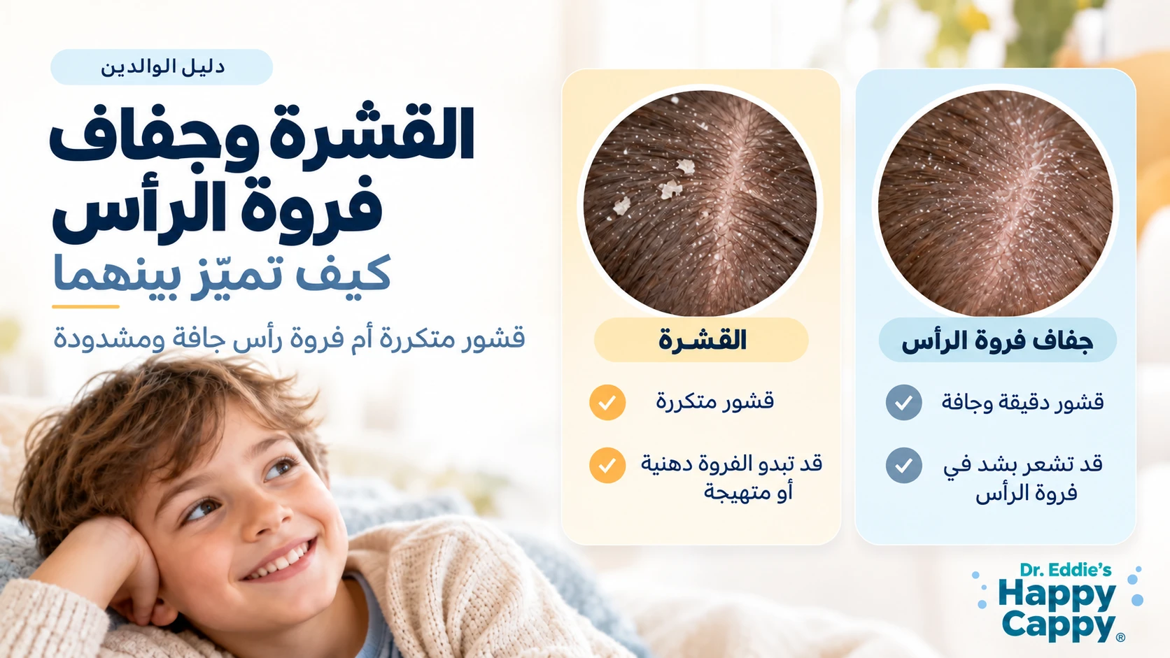 رسم بالعربية يقارن القشور المتكررة ودهنية أو تهيج الفروة في القشرة بالقشور الدقيقة والجافة وشعور الشد في جفاف فروة الرأس.