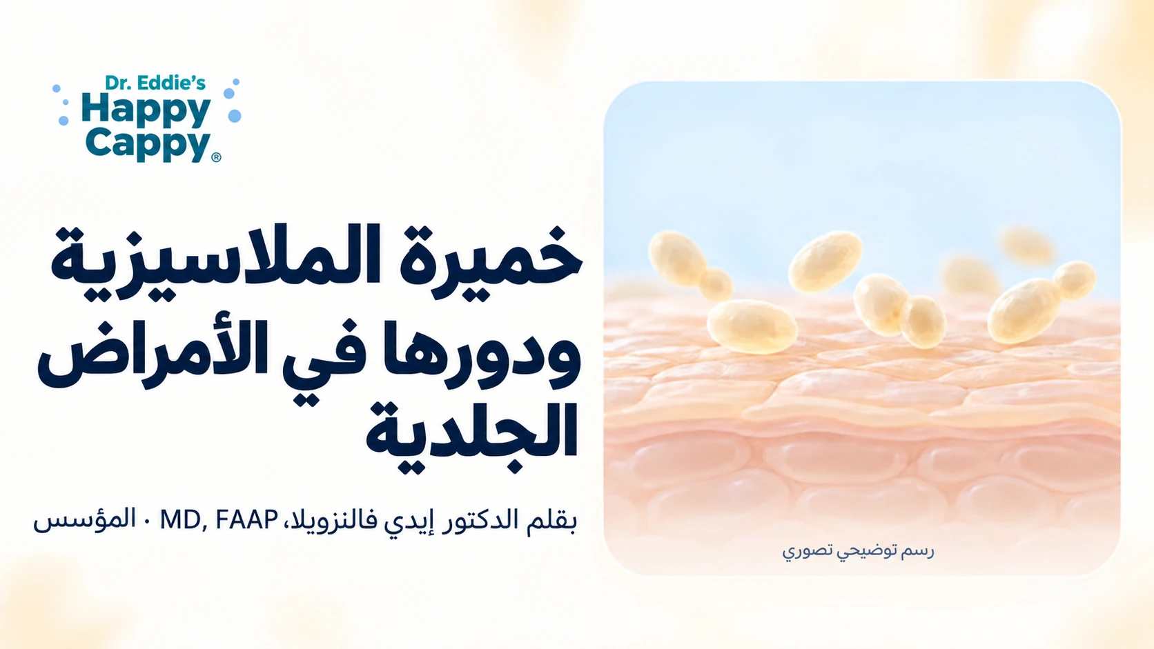 خميرة الملاسيزية ودورها في الأمراض الجلدية، مع رسم تصوري للخميرة قرب سطح الجلد.