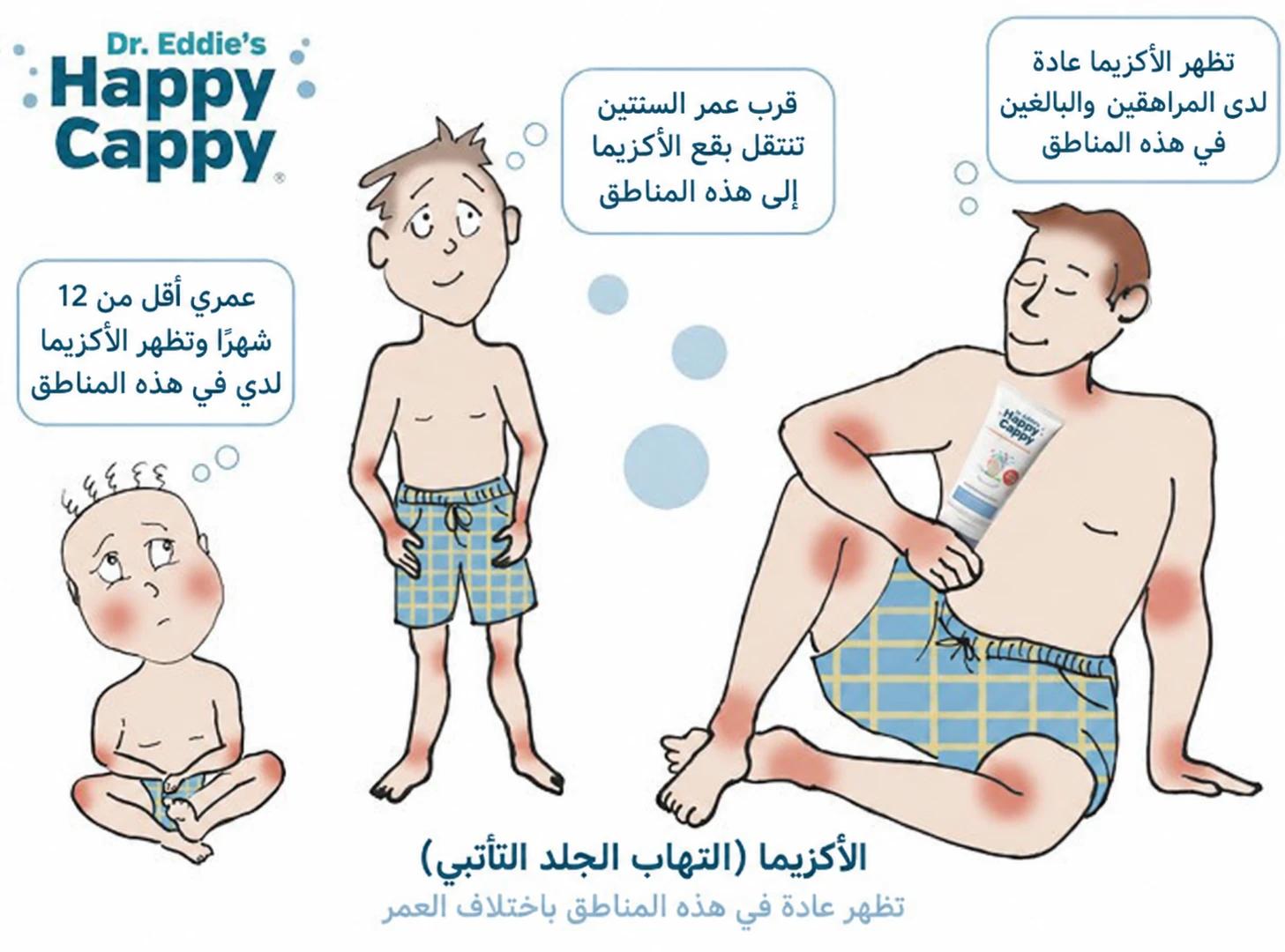 رسم توضيحي لمواضع الأكزيما الشائعة لدى رضيع وطفل وبالغ