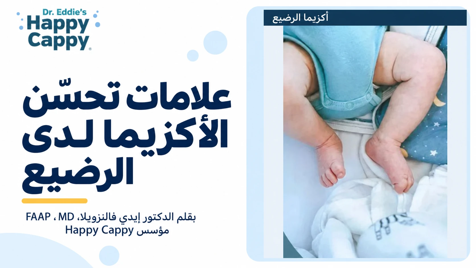 علامات تحسّن الأكزيما لدى الرضيع. صورة توضيحية لساقي رضيع وليست صورة لنتائج علاج.
