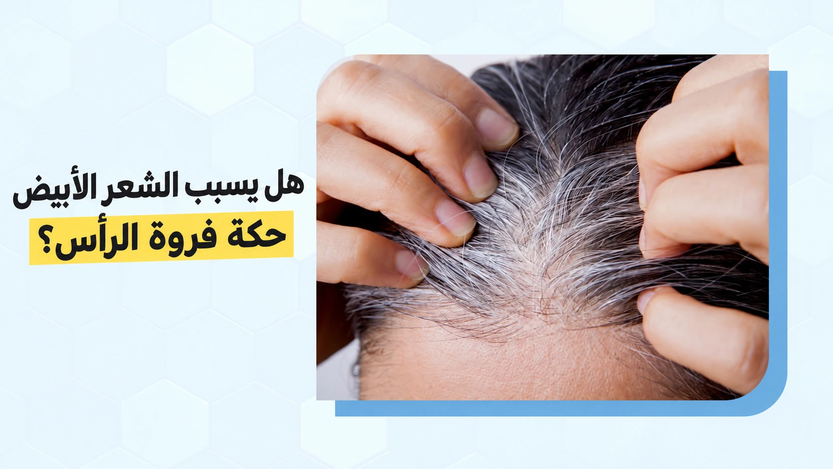 يدان تفرقان شعرًا أشيب بجانب السؤال: هل يجعل الشعر الأبيض فروة رأسك تحك؟