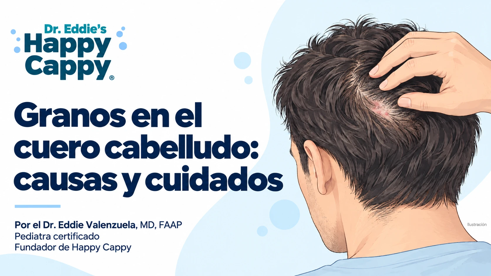 Granos en el cuero cabelludo: causas y cuidados